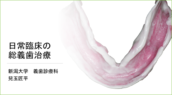 安定性の高い入れ歯をご提供いたします