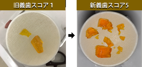 機能回復を視覚的に患者さまと共有
