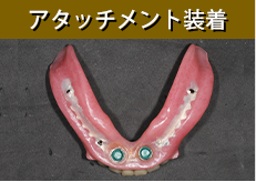 アタッチメント装着