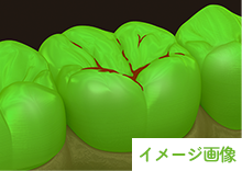 蛍光モード
